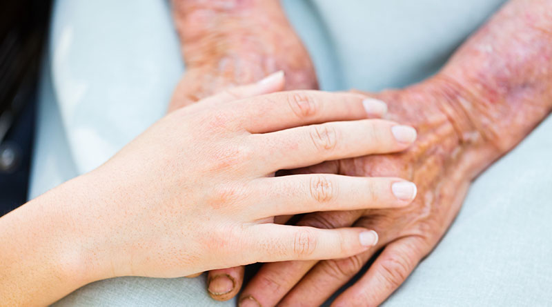 Government Launches Major Reassessment of Carer’s Allowance After Scandal